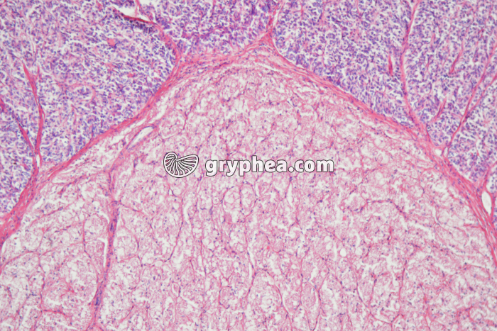 Hypophyse - détail de la tige pituitaire CT x25 - gryphea.com